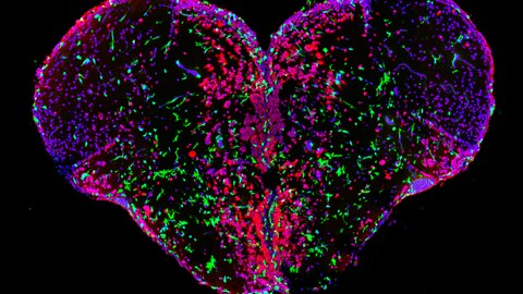 The image shows the spatial organization of immune cells (green) and neurons (red) on a cross section of adult zebrafish forebrain (cell nuclei: blue). 