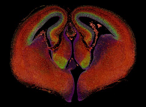 Querschnitt durch das Maus-Hirn am Embryonaltag 15 (neurale Stammzellen in Magenta, Neuronenvorläufer in Grün, Neuronen in Rot) 