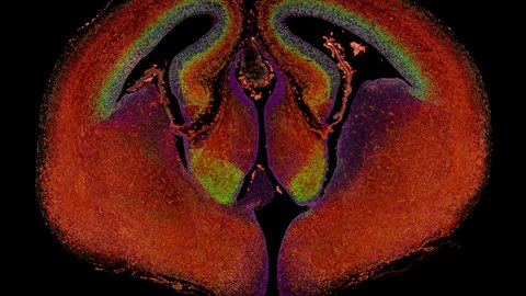 Querschnitt durch das Maus-Hirn am Embryonaltag 15 (neurale Stammzellen in Magenta, Neuronenvorläufer in Grün, Neuronen in Rot) 