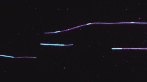 Tau (cyan) Inselbildung auf Mikrotubuli (magenta) in vitro