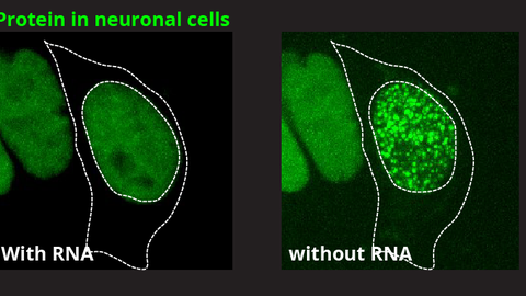 iPS cell-derived neural progenitors/ motor neurons with FUS protein (green) showing different distribution in presence and absence of ribonucleic acids