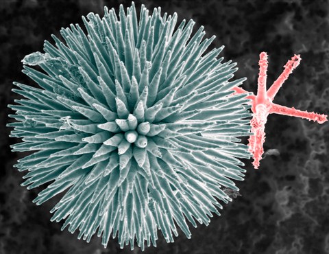 Two types of microscleres extracted from the Demosponge Geodia cydonium