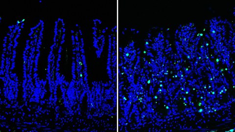 Gesunder (rechts) vs. kranker (links) Darm: Ein ausgedehnter DNA-Schaden (grün) innerhalb des Darmepithels führt zum entzündlichen Zelltod und beschädigt den Darm