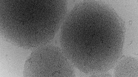  Kryo-Elektronenmikroskopie-Abbildung eines biomolekularen Kondensates eines Prionproteins