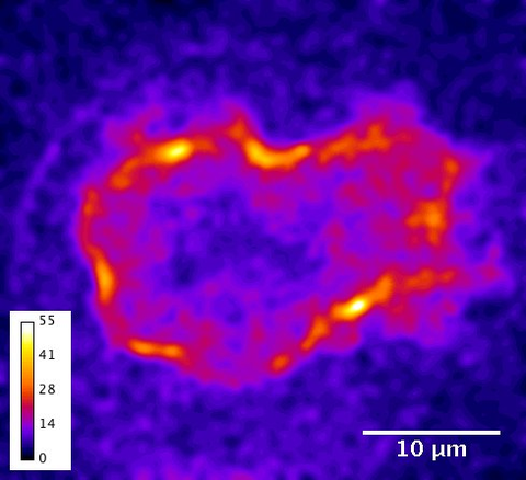 Aktive Kraftgeneratoren (Myosin), die Muster im Kortex einer zusammengedrückten, sich teilenden Zelle bilden