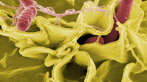 Microscopy image showing salmonella