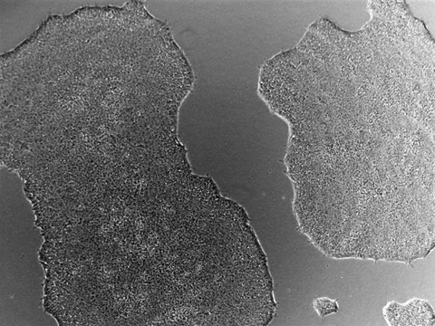 Colonies of the CRTDi004-A hiPSC line imaged with a phase contrast microscope.