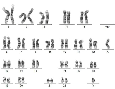 Sorted metaphase chromosomes of the CRTD1 human iPSC line with an intact 46,XY karyotype.