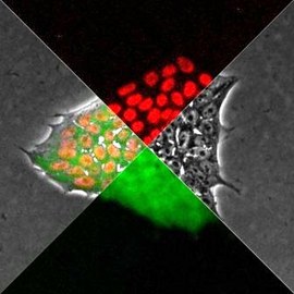 Wildtyp FUS-Protein fusioniert mit FusionRed und mutiertes FUS mit eGFP in humanen induzierten pluripotenten Stammzellen (iPSC) für das Sterneckert Labor (CRTD).