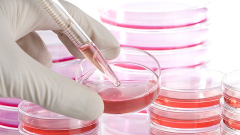 Das Foto zeigt die Hand einer Person. Sie hat eine Petrischale mit einer roten Flüssigkeit in der Hand. Mit Hilfe einer Pipette entnimmt die Person einen Teil der Flüssigkeit. Im Hintergrund stehen viele weitere Petrischalen mit dieser roten Flüssigkeit.