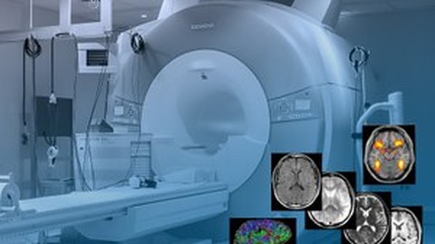 Magnetic resonance imaging with depictions of brains