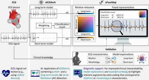 ecgXfusion Concept