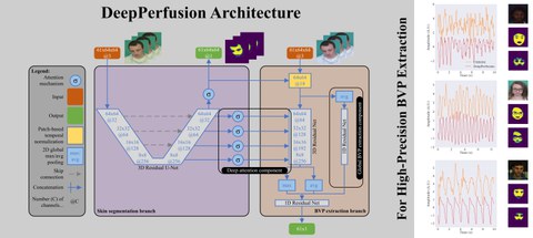 Funktionsweise DeepPerfusion