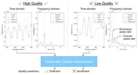 Prinzip der automatisierten Qualitätsbewertung von iPPG-Signalen mit einem SQI-Filter