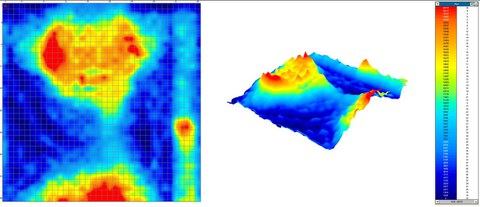 Torsobarographie