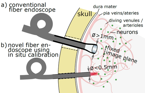 Endoscopeb