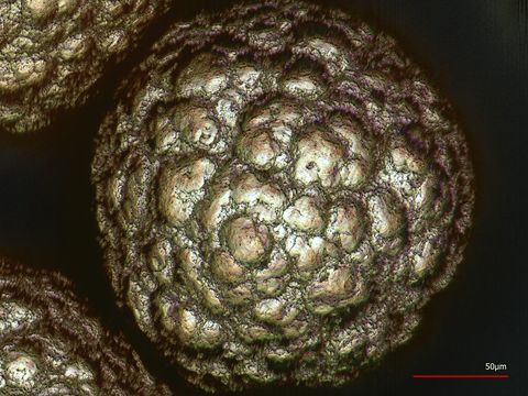 Mikroskopische Aufnahme eines Nickel Partikels