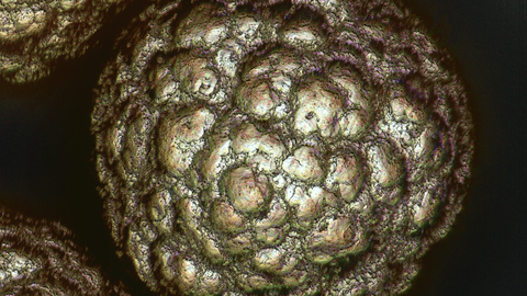 Microscopic image of a nickel particle