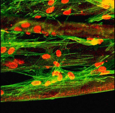 Mesenchymale Stammzellen
