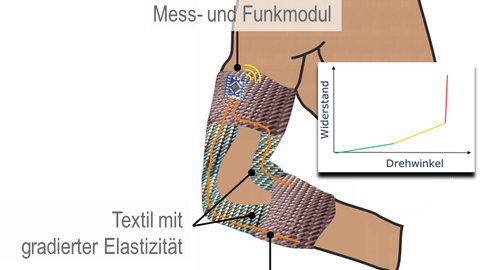 Abbildung TEXoSiut