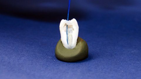 Halbschnitt eines humanen Zahnes mit in den Wurzelkanal eingeführter GFK-Instrumentenspitze.