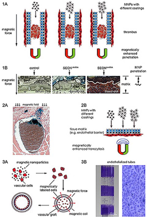 Abb. 1 Thrombolyse. (A) Prinzip der zielgerichteten (B) Eindringen von Nanopartikel in Serum- bzw. Blutplomben Abb. 2 Drug Targeting. (A) Infiltration von magnetischen Nanopartikeln in das Tumorgewebe. (B) Prinzip der magnetisch verstärkten Transzytose.