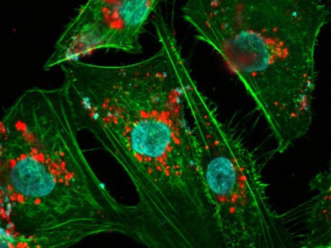 HBMEC Zellen wurden mit Stärke-umhüllten Eisenoxid-Nanopartikeln