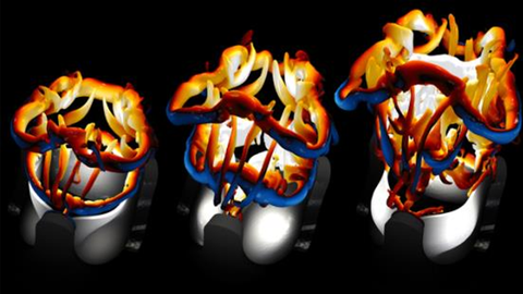 Herzklappendarstellung