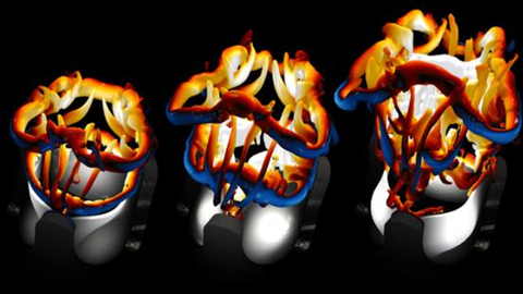 Herzklappendarstellung