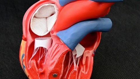 Gewebte integral gefertigte Implantate für das Herz-Kreislaufsystem 