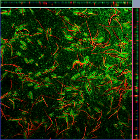 Konfokale Laser Scanning Mikroskopie von Cyanothece sp. Verfahrenstechnik studieren.