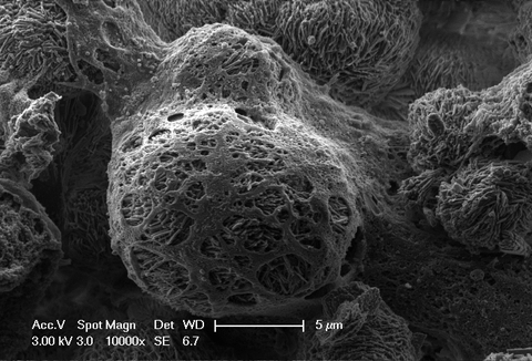 Rasterelektronenmikroskopische Aufnahme eines Stronitumphosphat-Biomaterials. Die kugelförmigen Mineralpartikel bestehen aus einzelnen Kristalliten, die sich zu Kugeln zusammenlagern. Darüber befindet sich ein Netz aus Zellrückständen nach der Biokompatibilitätsuntersuchung.