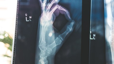 Röntgenhand