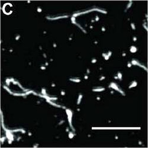 Fig.1 taken from Aleksandrowicz et al, 2011