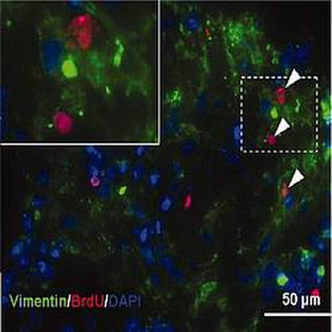 Fig.2 taken from Chung et al, 2009