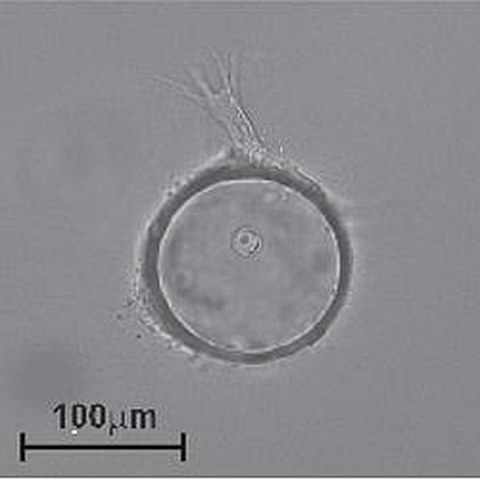 Fig.4 taken from Economopoulou et al, 2015.