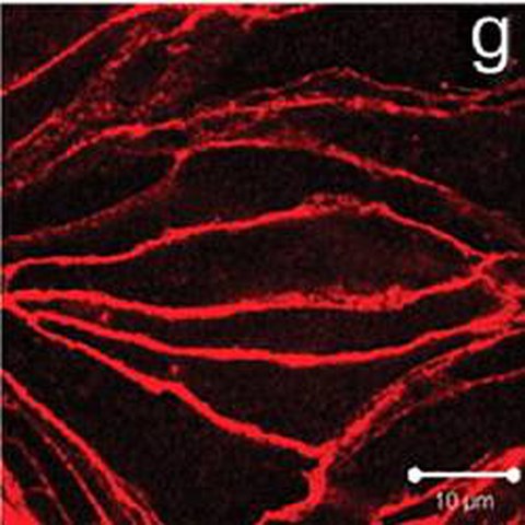 Fig.3 taken from Kronstein et al, 2012