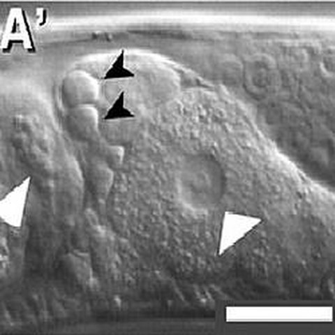 Fig.2 taken from Kupinski et al, 2010