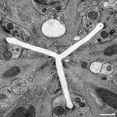 Fig.1 taken from Müller-Reichert et al, 2010