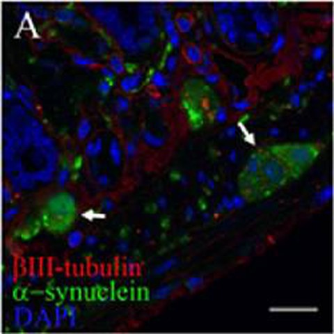 Fig.2 taken from Pan-Montojo et al,2010