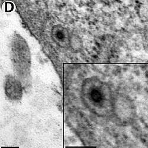 -Fig.1 taken from Stirnnangel et al, 2012.