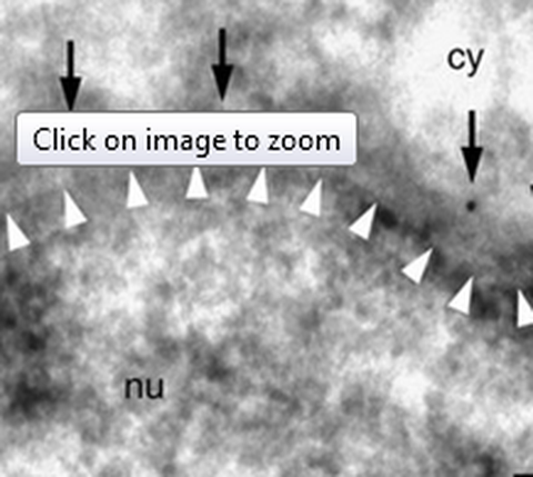 image taken from Wolf et al., 2016