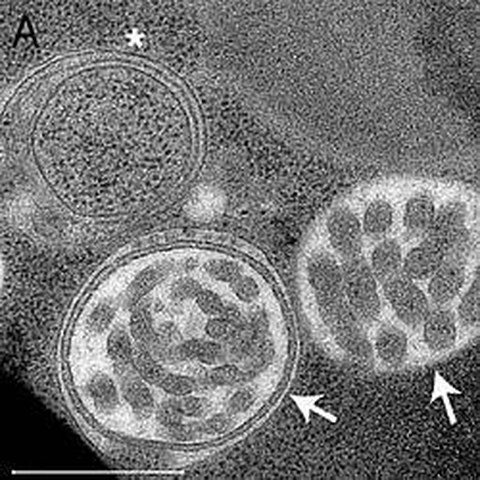 Fig.1 taken from Gloor et al, 2012