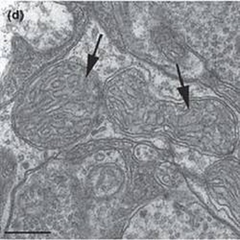Fig.10 taken from Knels et al, 2008.