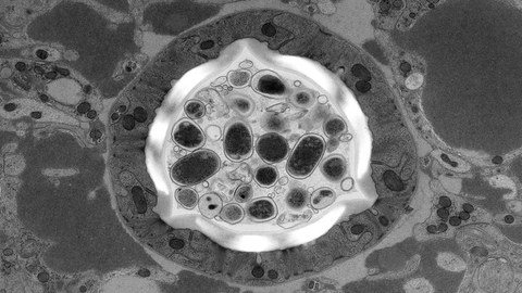 Electron Microscopy