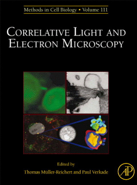 Correlative Light and Electron Microscopy II