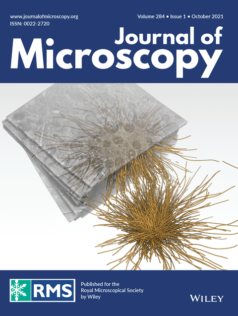 Cover Journal of Microscopy. Volume 284