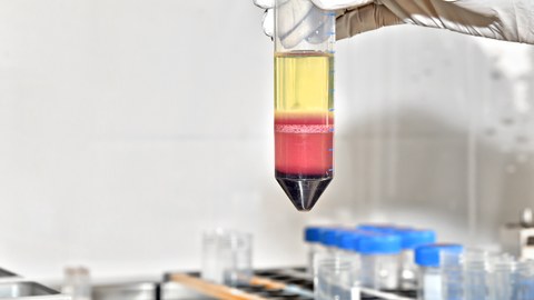 Separation von Zellen in einem Serumröhrchen in der BioBank Dresden