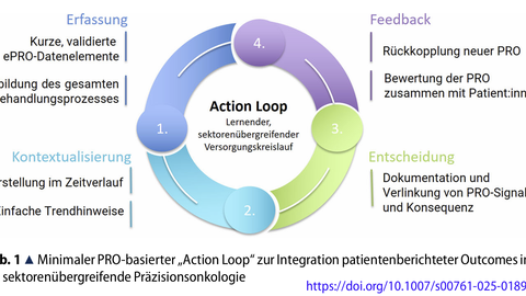 Action Loop         