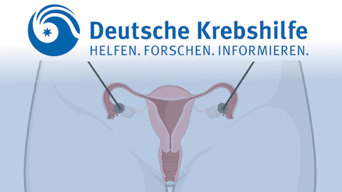 Krebshilfeprojekt Figure